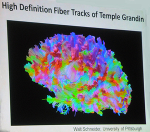 High Definition Brain Scan