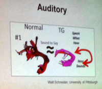 Auditory Nerve Bundles